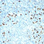 Formalin-fixed, paraffin embedded human tonsil sections stained with 100 ul anti-Lambda Light Chain (clone ICO-106) at 1:50. HIER epitope retrieval prior to staining was performed in 10mM Citrate, pH 6.0.